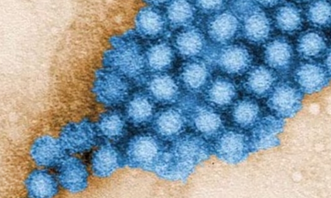 加拿大和英美等国诺罗病毒感染病例增加