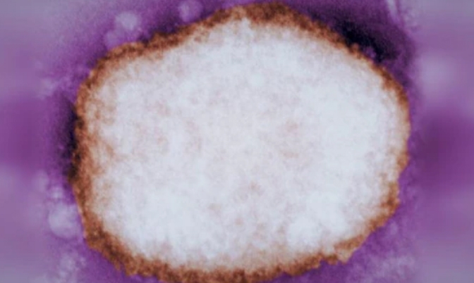 出国小心猴痘：加拿大公共卫生署发布警告